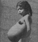 Colombian girl, age 10, gives birth: Is she youngest mom in history?